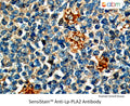 SensiStain™ Anti-Lp-PLA2 Antibody – Figure 1 of 1