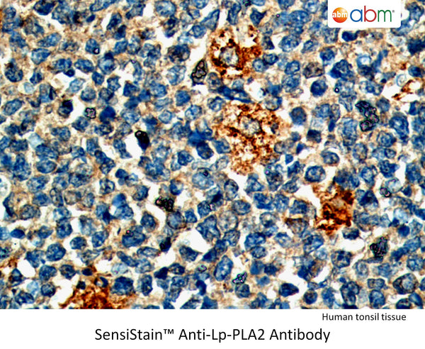 SensiStain™ Anti-Lp-PLA2 Antibody – Figure 1 of 1