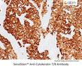 SensiStain™ Anti-Cytokeratin 7/8 Antibody – Figure 1 of 1