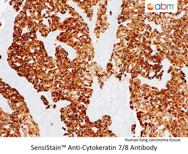 SensiStain™ Anti-Cytokeratin 7/8 Antibody – Figure 1 of 1