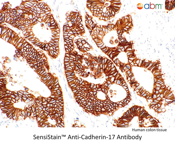 SensiStain™ Anti-Cadherin-17 Antibody – Figure 1 of 1