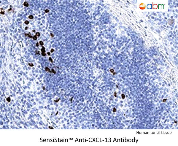 SensiStain™ Anti-CXCL-13 Antibody – Figure 1 of 1