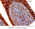 SensiStain™ Anti-Fascin Antibody – Figure 1 of 1