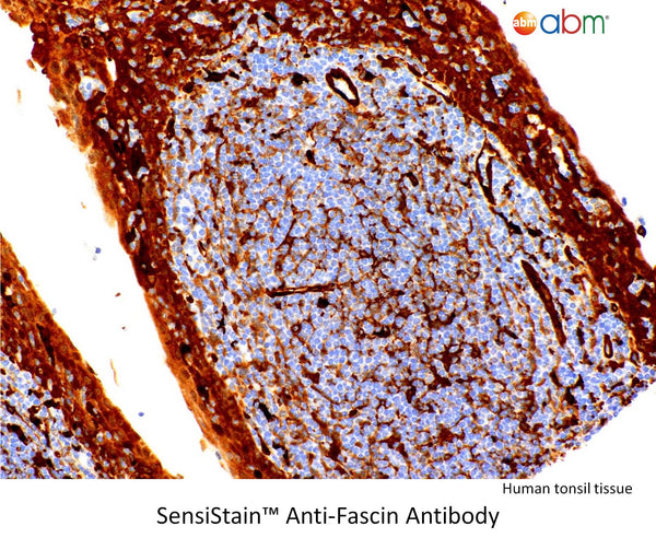 SensiStain™ Anti-Fascin Antibody – Figure 1 of 1