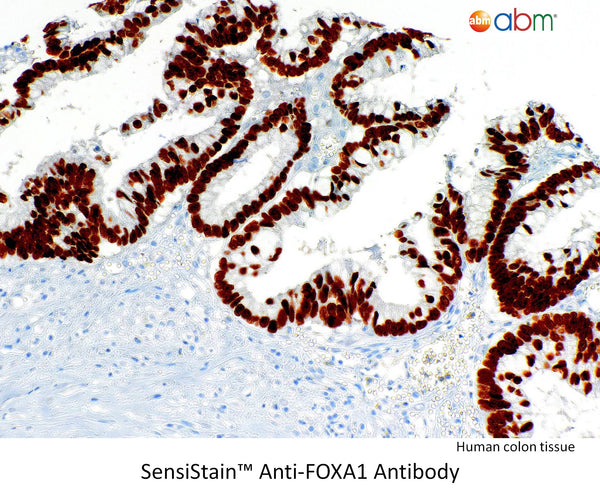 SensiStain™ Anti-FOXA1 Antibody – Figure 1 of 1