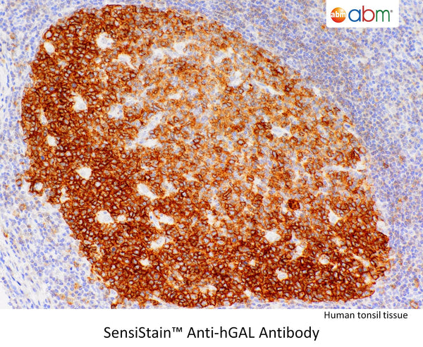 SensiStain™ Anti-hGAL Antibody – Figure 1 of 1