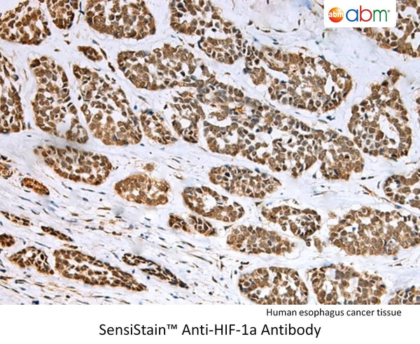 SensiStain™ Anti-HIF-1a Antibody – Figure 1 of 1