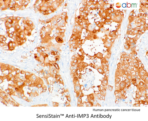 SensiStain™ Anti-IMP3 Antibody – Figure 1 of 1