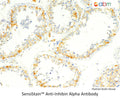 SensiStain™ Anti-Inhibin Alpha Antibody – Figure 1 of 1