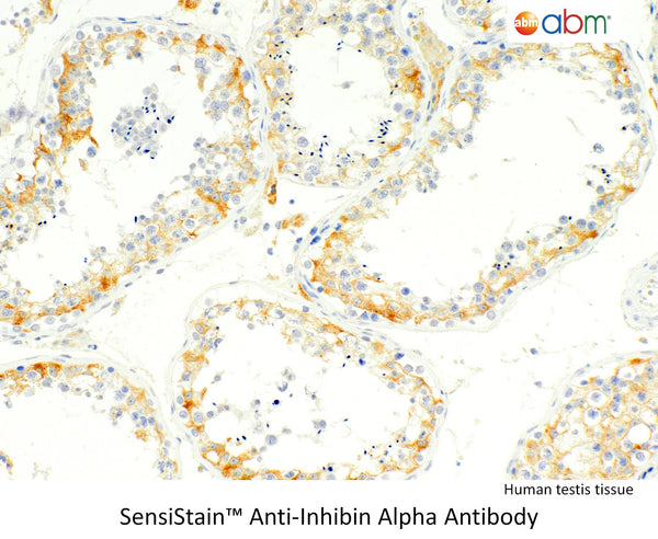 SensiStain™ Anti-Inhibin Alpha Antibody – Figure 1 of 1