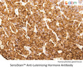 SensiStain™ Anti-Luteinizing Hormone (LH) Antibody – Figure 1 of 1