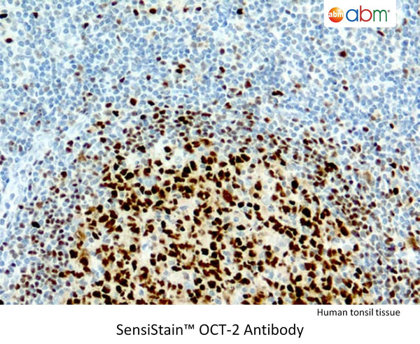 SensiStain™ Anti-OCT-2 Antibody – Figure 1 of 1