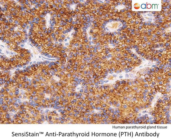 SensiStain™ Anti-Parathyroid Hormone (PTH) Antibody – Figure 1 of 1
