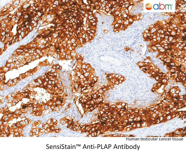 SensiStain™ Anti-PLAP Antibody – Figure 1 of 1