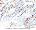 SensiStain™ Anti-Prostate Cocktail Antibody – Figure 1 of 1