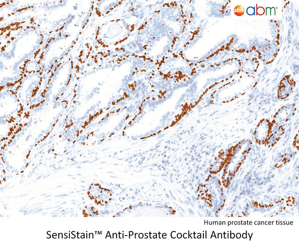 SensiStain™ Anti-Prostate Cocktail Antibody – Figure 1 of 1