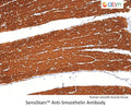 SensiStain™ Anti-Smoothelin Antibody – Figure 1 of 1