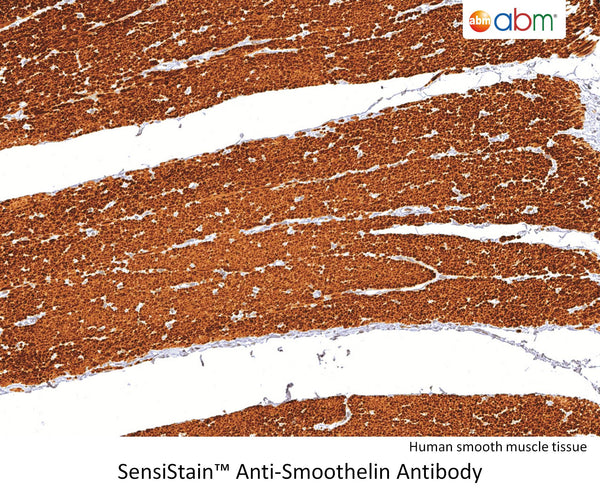 SensiStain™ Anti-Smoothelin Antibody – Figure 1 of 1