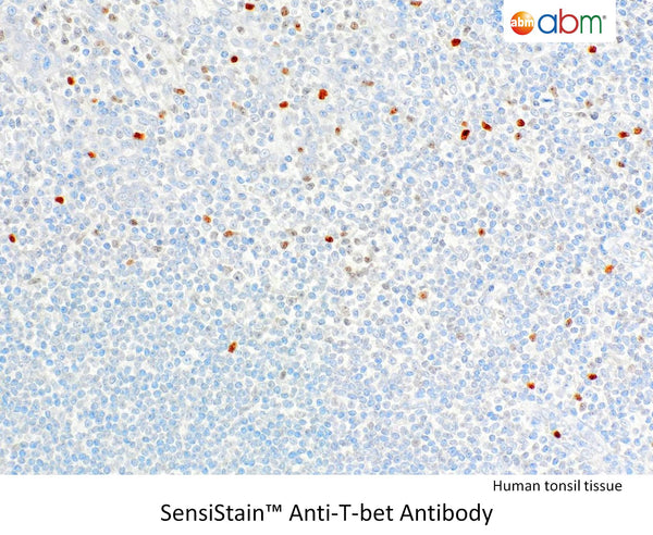 SensiStain™ Anti-T-bet Antibody – Figure 1 of 1