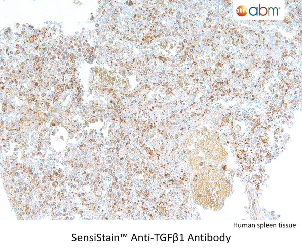 SensiStain™ Anti-TGFβ1 Antibody – Figure 1 of 1