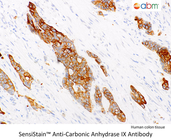 SensiStain™ Anti-Carbonic Anhydrase IX Antibody – Figure 1 of 1