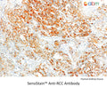 SensiStain™ Anti-RCC Antibody – Figure 1 of 1