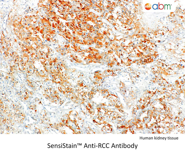 SensiStain™ Anti-RCC Antibody – Figure 1 of 1