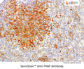 SensiStain™ Anti-Tartrate-Resistant Acid Phosphatase (TRAP) Antibody – Figure 1 of 1