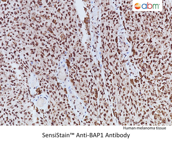 SensiStain™ Anti-BAP1 Antibody – Figure 1 of 1