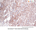 SensiStain™ Anti-SS18-SSX Antibody – Figure 1 of 1