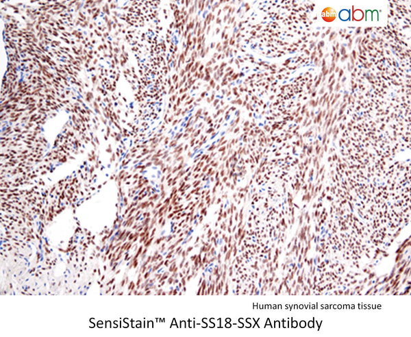 SensiStain™ Anti-SS18-SSX Antibody – Figure 1 of 1