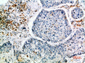 CIS Polyclonal Antibody – Figure 1 of 1