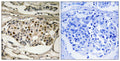 NFκB-p65(Phospho Ser281) Polyclonal Antibody – Figure 1 of 1