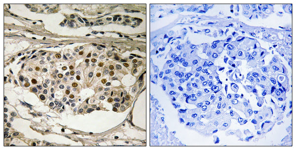 NFκB-p65(Phospho Ser281) Polyclonal Antibody – Figure 1 of 1