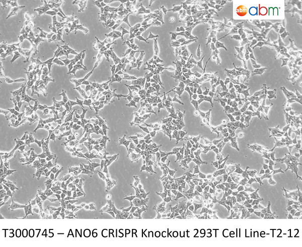 ANO6 CRISPR Knockout 293T Cell Line-T2-12 – Figure 1 of 1
