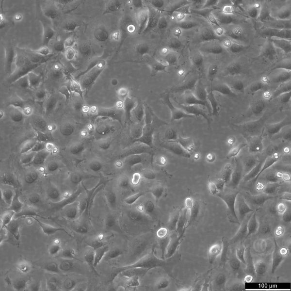 J82 cell