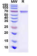 Recombinant Helicobacter pylori ureB/Urease subunit beta Protein, N-His