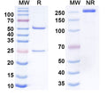 SDS-PAGE for Anti-Helicobacter pylori ureB/Urease subunit beta Antibody (HpU-17)