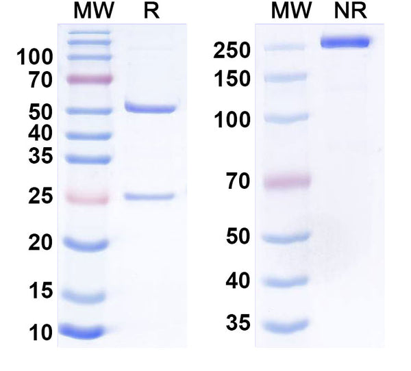 SDS-PAGE for Anti-Helicobacter pylori ureB/Urease subunit beta Antibody (HpU-17)