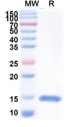 SDS-PAGE for Anti-Helicobacter pylori ureB/Urease subunit beta Nanobody (N01-C3).