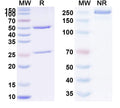 SDS-PAGE for Anti-Helicobacter pylori Urease Antibody (HpU-19)