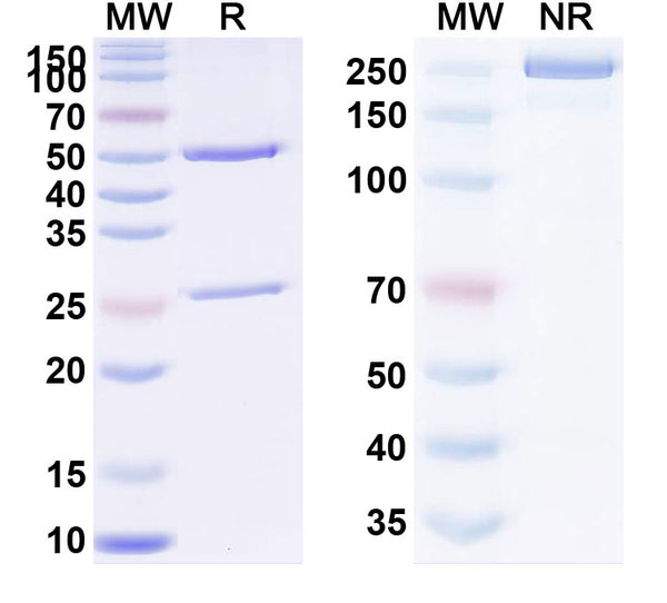 SDS-PAGE for Anti-Helicobacter pylori Urease Antibody (HpU-19)