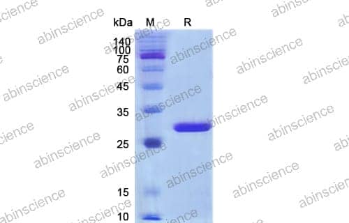 SDS-PAGE for SUMO Protease (ULP1)