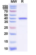 Recombinant Yersinia enterocolitica Invasin Protein, N-His-SUMO