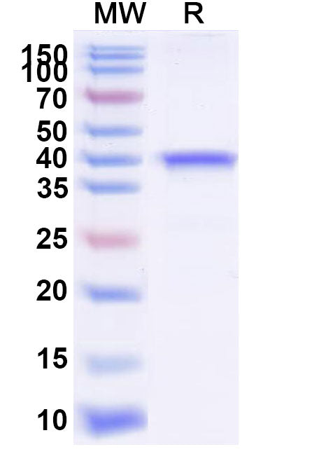Recombinant Yersinia enterocolitica Invasin Protein, N-His-SUMO