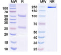 SDS-PAGE for Anti-Bordetella pertussis fhaB/FHA Antibody (T5).