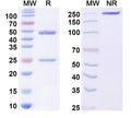 SDS-PAGE for Anti-Dermatophagoides pteronyssinus DERP2 Antibody (5D10)