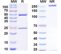SDS-PAGE for Anti-DERP2 Antibody (SAA0624)