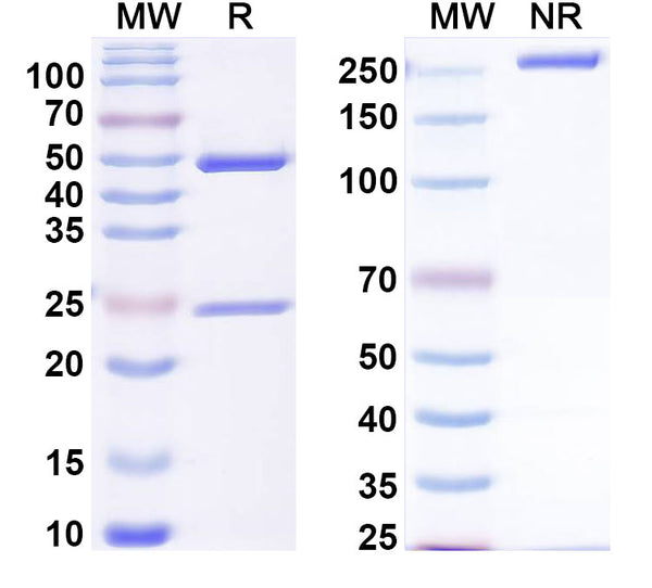 SDS-PAGE for Anti-DERP2 Antibody (SAA0624)
