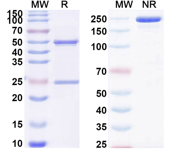 SDS-PAGE for Anti-DERP2 Antibody (SAA0627)